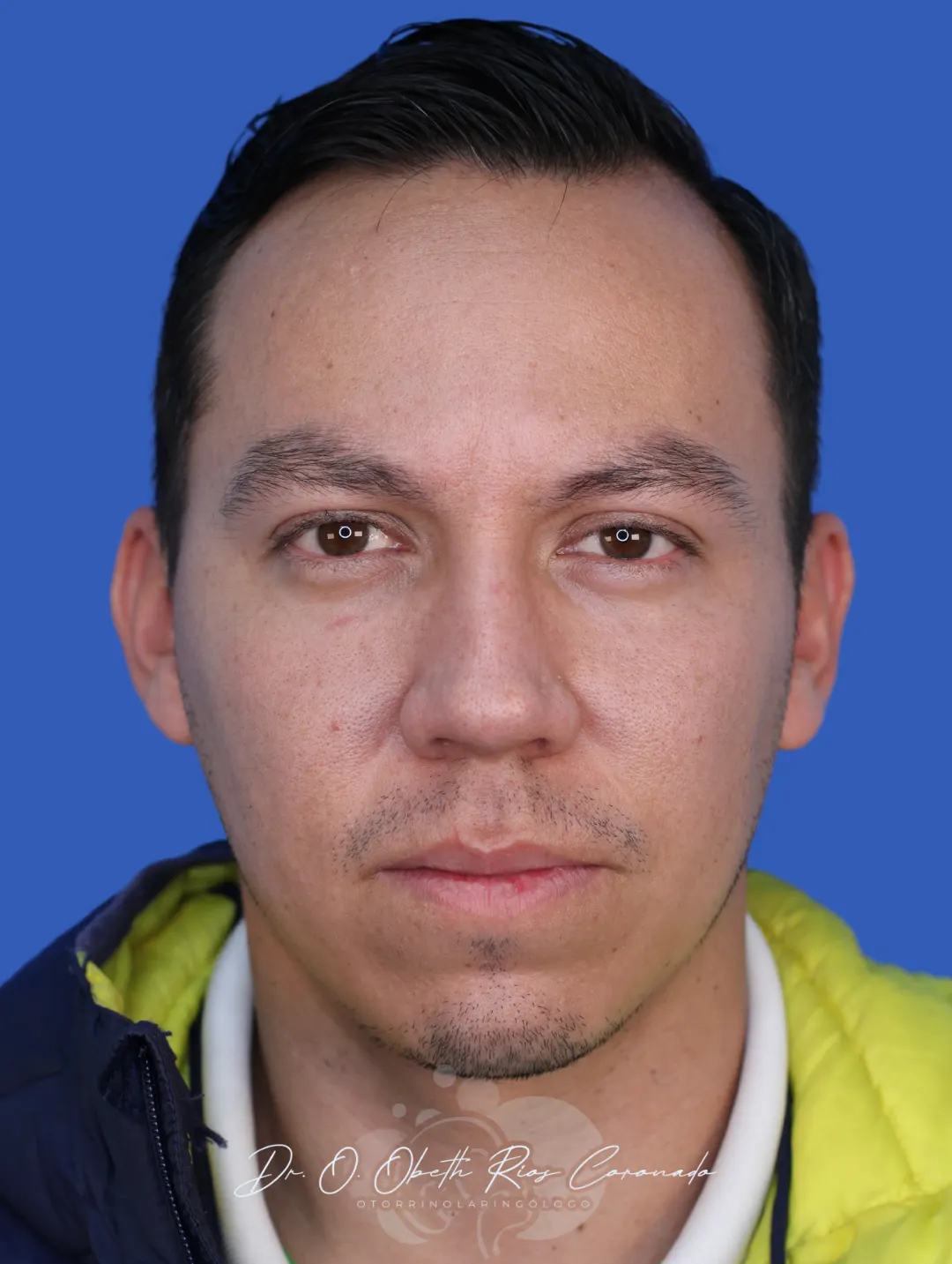 Caso real de Francisco Espinosa