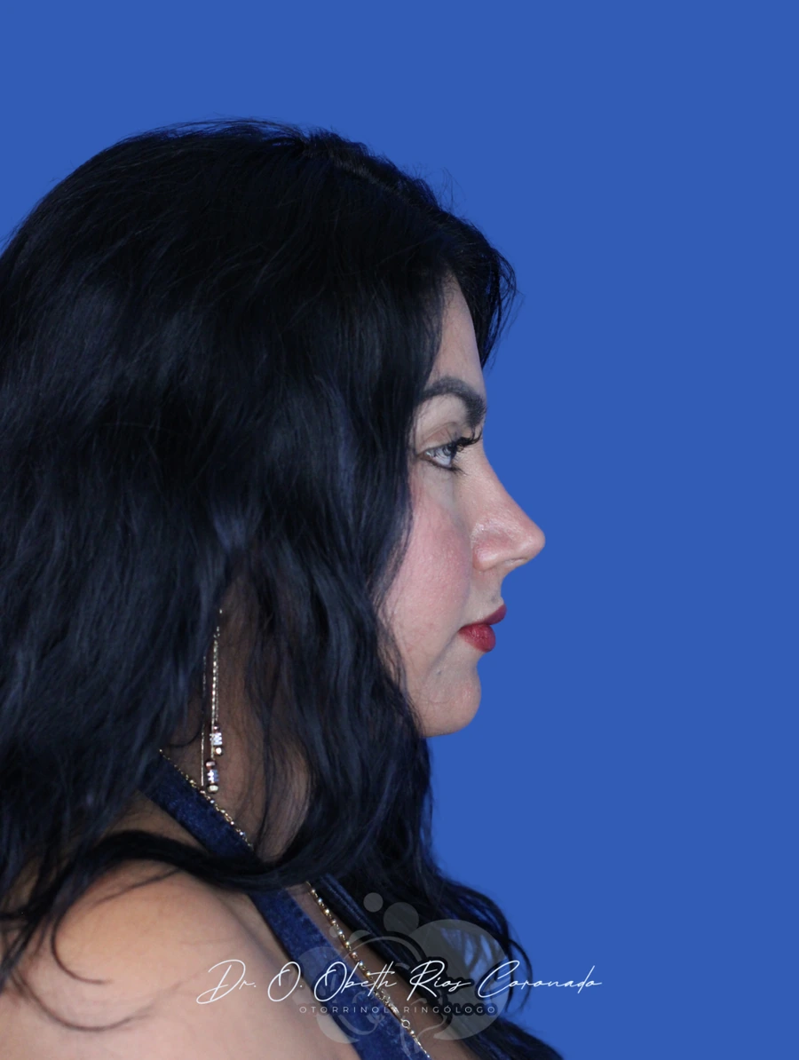 Caso de Yesenia Suriano